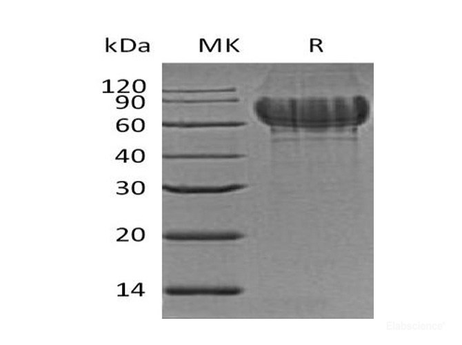 Recombinant Mouse Bone Sialoprotein 2 / IBSP Protein (C-His)-Elabscience