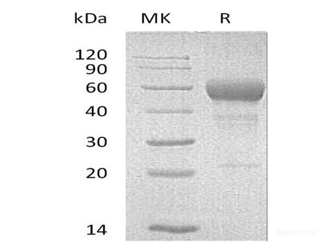 Recombinant Mouse CD95 / TNFRSF6 / FAS Protein (C-Fc)-Elabscience