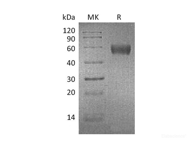 Recombinant Mouse Apolipoprotein H / APOH Protein (C-His)-Elabscience