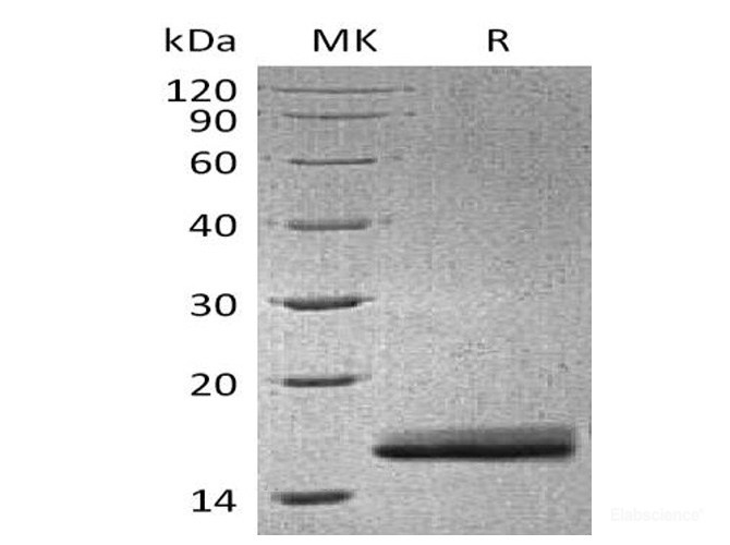 Recombinant Mouse AGR3 Protein (C-His)-Elabscience