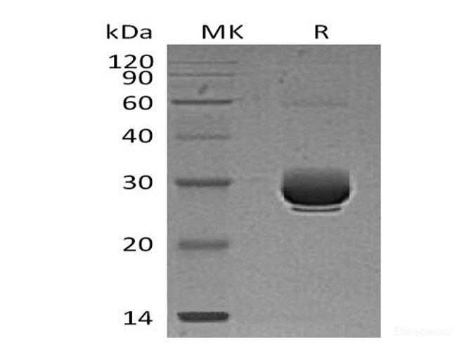Recombinant Mouse Angiopoietin-like Protein 3 / ANGPTL3 Protein (C-His)-Elabscience