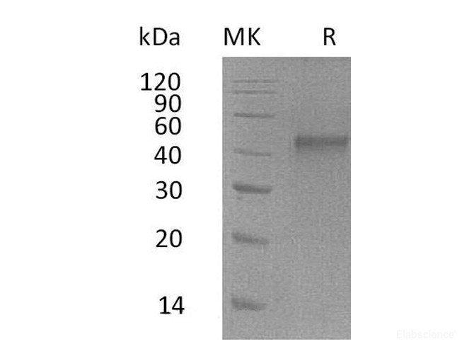 Recombinant Mouse ST6GALNAC2 / SIAT7-B Protein (C-His)-Elabscience