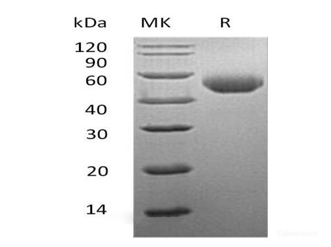 Recombinant Mouse Serpin A1 / A1AT Protein (C-His)-Elabscience