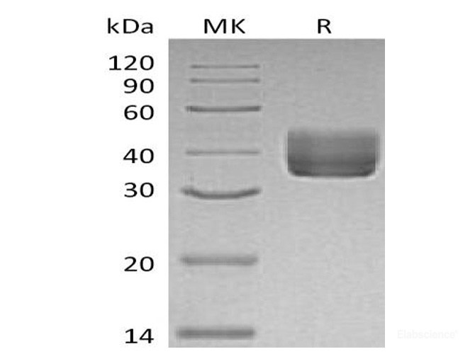 Recombinant Mouse CD157 / BST1 Protein (C-His)-Elabscience