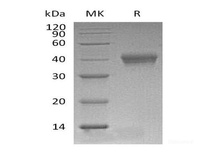 Recombinant Mouse CD38 Protein (C-His)-Elabscience