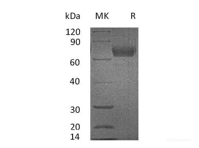 Recombinant Mouse IL4R / CD124 Protein (C-Fc)-Elabscience