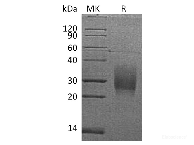 Recombinant Mouse TRAILR2 / TNFRSF10B / CD262 Protein (C-Avi-His)-Elabscience