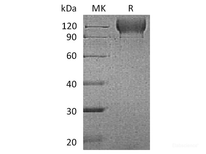 Recombinant Mouse P-selectin / CD62P Protein (C-AVI-His)-Elabscience