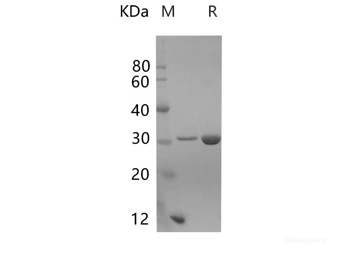 Recombinant Mouse GSTM1 Protein (His Tag)-Elabscience