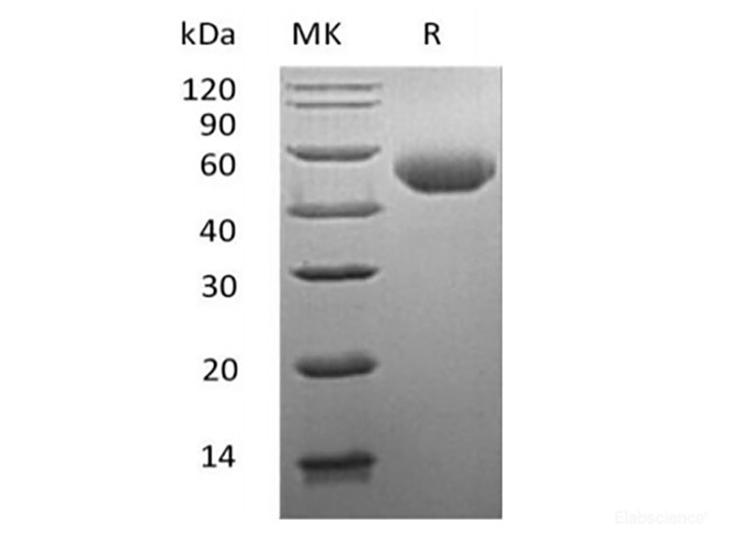 Recombinant Mouse Alpha-1-antitrypsin 1-1/Serpin A1e (C-6His)