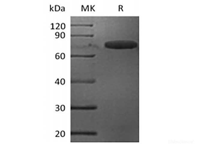 Recombinant Mouse Leukocyte Ig-Like Receptor B4/LILRB4/CD85k/ILT3 (C-Fc)