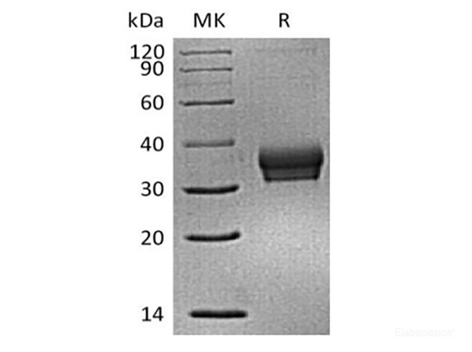 Recombinant Mouse Sialic acid-binding Ig-like lectin 15/Siglec-15/CD33L3 (C-6His)