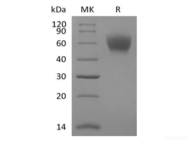Recombinant Mouse TPBG/5T4 (C-6His)