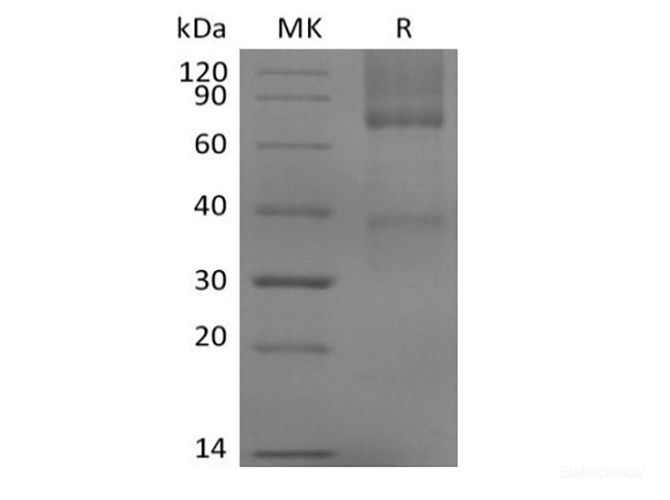 Recombinant Mouse Glypican-3/GPC3/OCI5 (C-6His)
