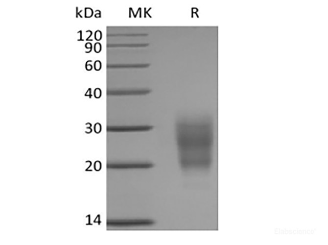 Recombinant Mouse NKG2-D type II Integral Membrane Protein/NKG2D/CD314 (N-6His)