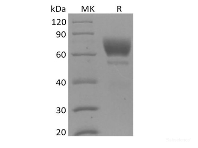 Recombinant Mouse Tyrosine-protein kinase receptor UFO/AXL oncogene/UFO (C-6His)