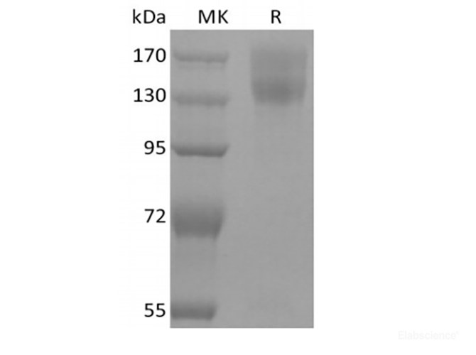 Recombinant Mouse Leptin Receptor/LEPR/CD295 (C-mFc)