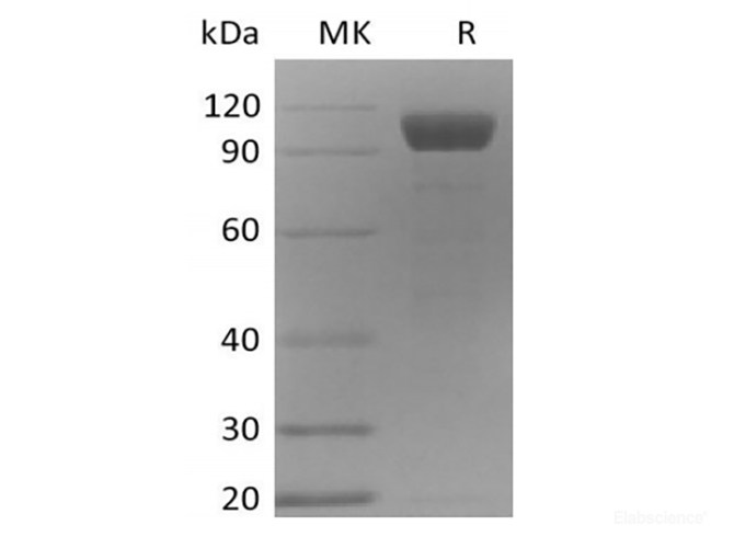 Recombinant Mouse Angiopoietin-2/ANG2 (C-Fc)