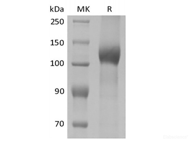 Recombinant Mouse Leptin Receptor/LEPR/CD295 (C-10His)
