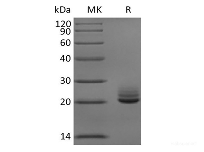 Recombinant Mouse Fibroblast Growth Factor 21/FGF-21 (C-6His)
