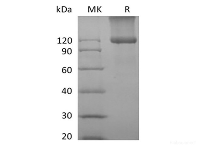 Recombinant Mouse TGFBR3 (C-6His)