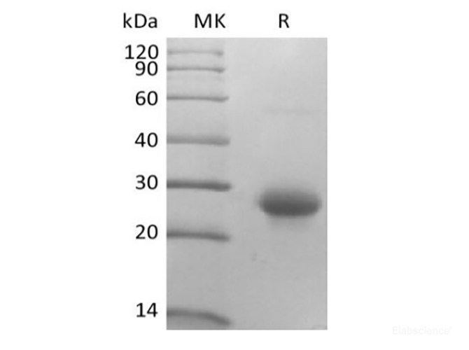 Recombinant Mouse CD27 Ligand/TNFSF7/CD70 (N-10His)