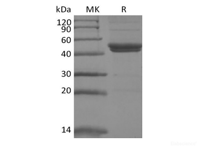 Recombinant Mouse IL-11RA (C-6His)