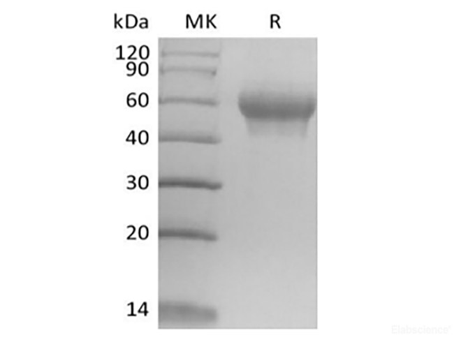 Recombinant Mouse IL-6 Receptor Subunit  alpha/IL-6RA/CD126 (C-6His)
