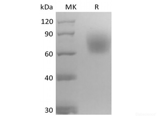 Recombinant Mouse Neurotrophic Tyrosine Kinase Receptor Type 2/TrkB/NTRK2 (C-6His)