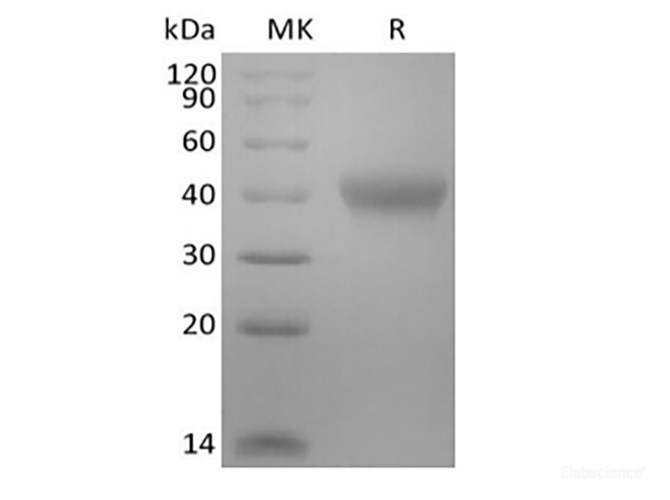 Recombinant Mouse TNF Receptor II/TNF RII/TNFRSF1B/CD120b  (C-6His-Avi) Biotinylated
