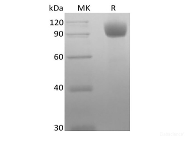 Recombinant Mouse Angiotensin-Converting Enzyme 2/ACE-2 (C-10His)