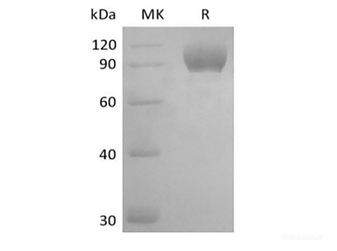 Recombinant Mouse Tyrosine-protein kinase receptor UFO/AXL oncogene/UFO (C-FC)