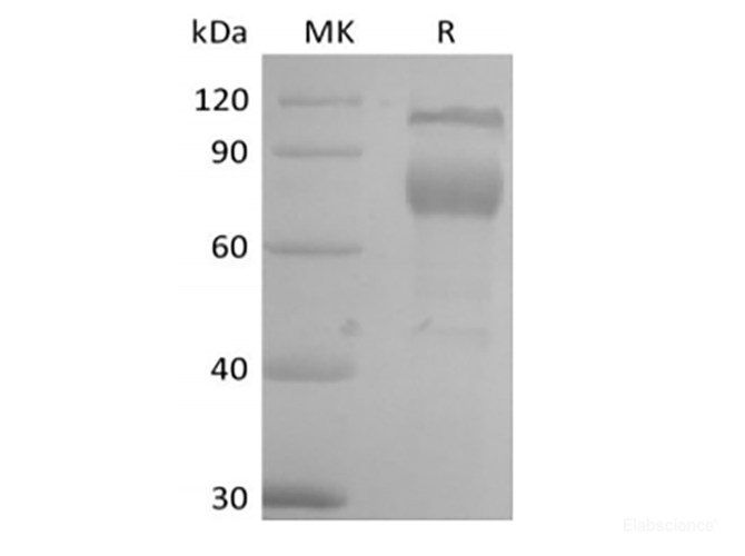 Recombinant Mouse IL-2 Receptor Subunit Beta/IL-2RB/CD122 (C-Fc)