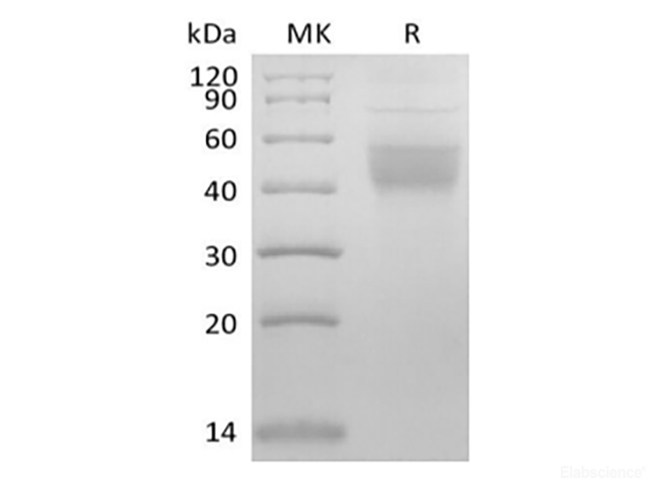 Recombinant Mouse IL-2 Receptor Subunit Beta/IL-2RB/CD122 (C-6His)