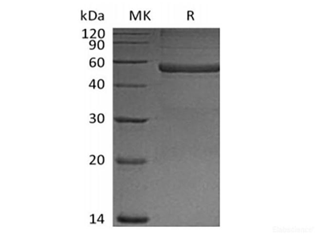 Recombinant Mouse Pentraxin-related protein PTX3(N-6His)