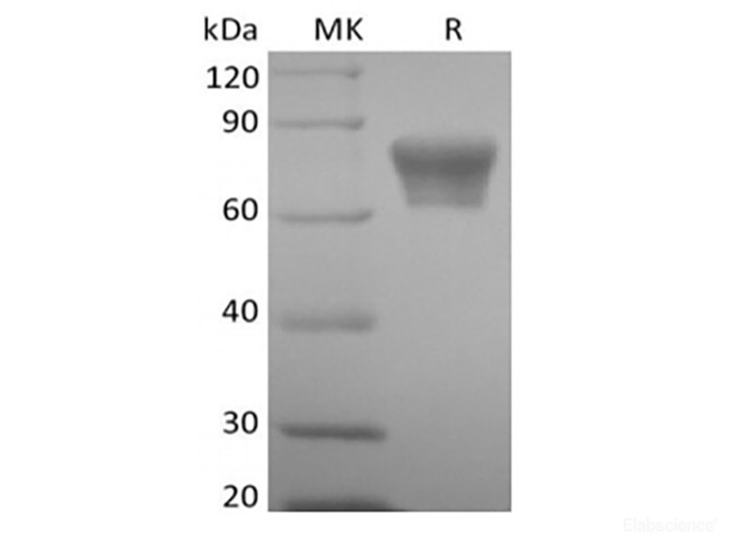 Recombinant Mouse TNF Receptor II/TNF RII/TNFRSF1B/CD120b  (C-Fc)