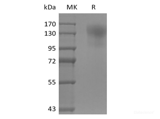 Recombinant Mouse CD45/PTPRC (C-6His)