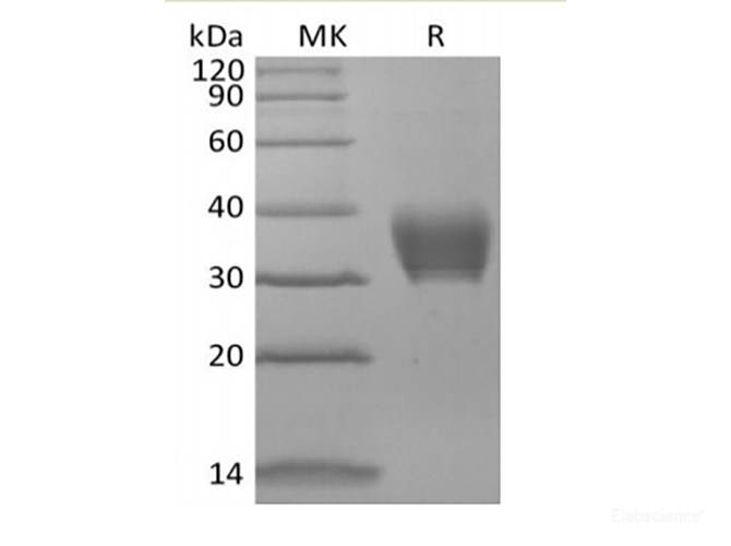 Recombinant Mouse BTNL4 (C-6His)