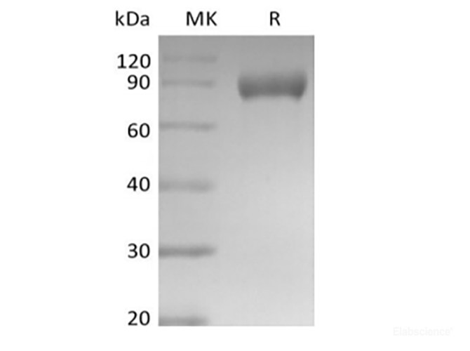 Recombinant Mouse Siglec-E (C-Fc)