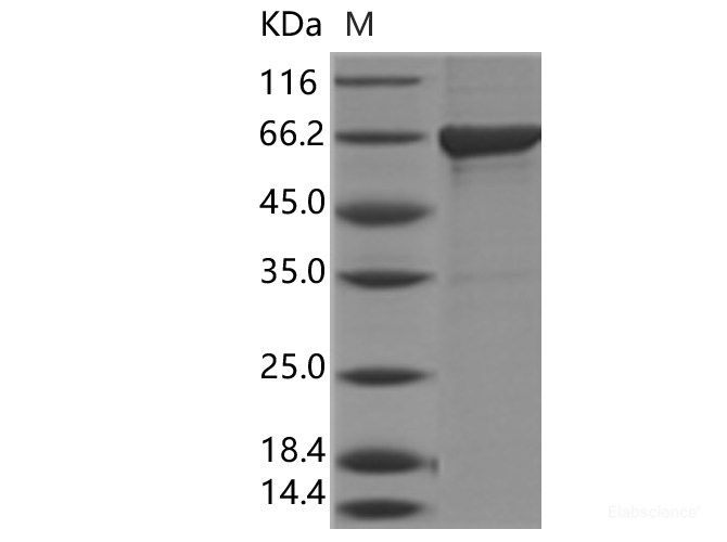Recombinant Influenza B (B/Florida/4/2006) Nucleoprotein / NP Protein (His Tag)-Elabscience