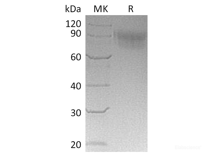 Recombinant Cynomolgus SIGLEC5 / CD170 Protein (C-His)-Elabscience