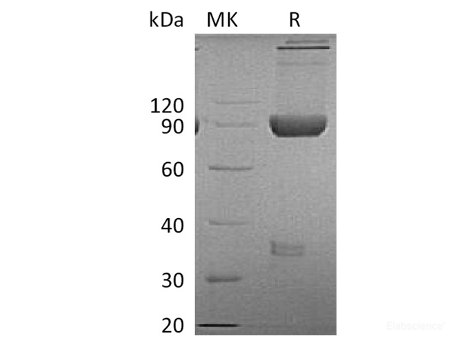 Recombinant Cynomolgus LAG-3 / CD223 Protein (C-Fc)-Elabscience