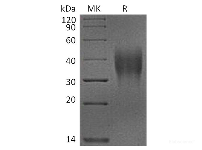 Recombinant Cynomolgus VSIR Protein (C-His)-Elabscience