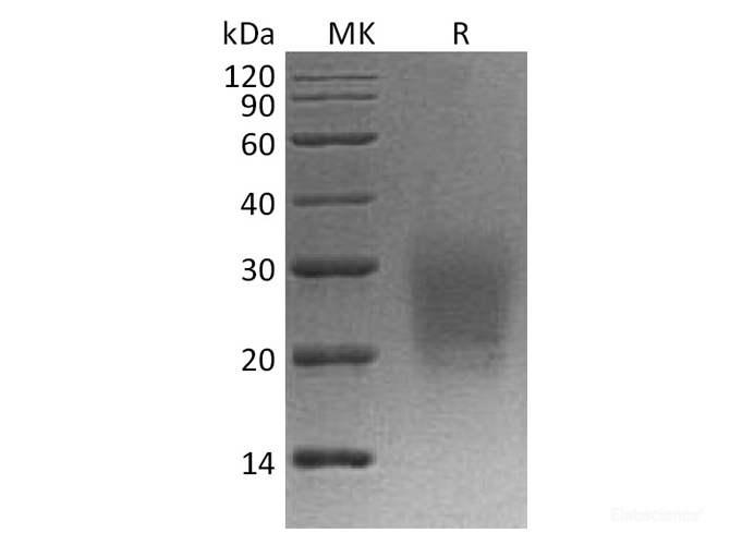 Recombinant Cynomolgus CD3d / CD3 delta Protein Protein (C-His)-Elabscience