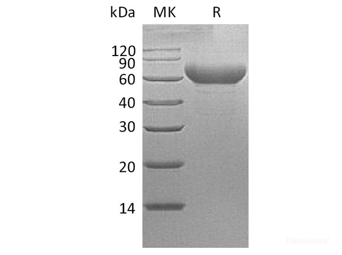 Recombinant Cynomolgus TIM-3 / HAVCR2 Protein (C-Fc)-Elabscience