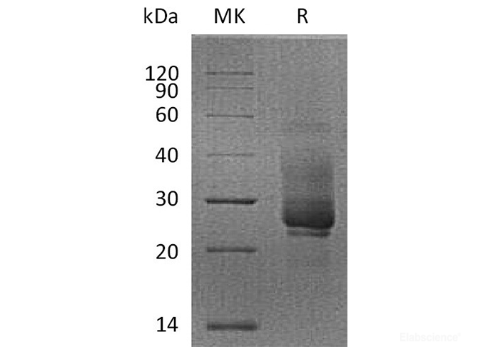 Recombinant Cynomolgus TIM-3 / HAVCR2 Protein (N-His)-Elabscience