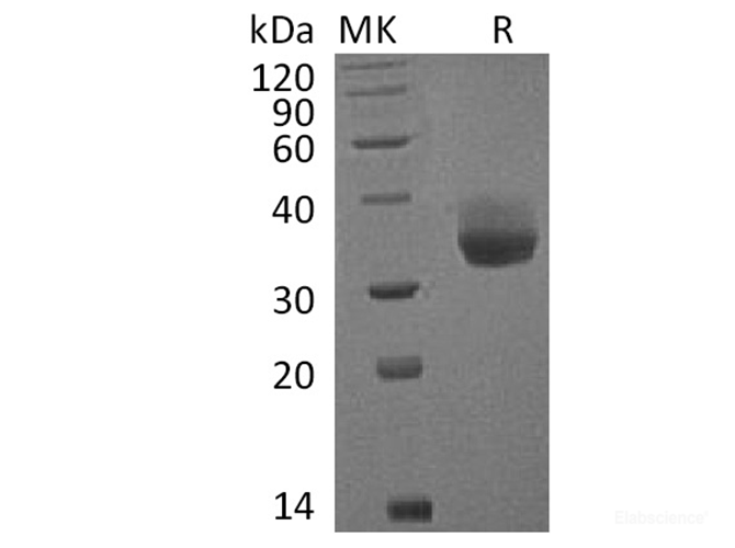 Recombinant Cynomolgus PD-L1 / B7-H1 / CD274 Protein (C-His)-Elabscience