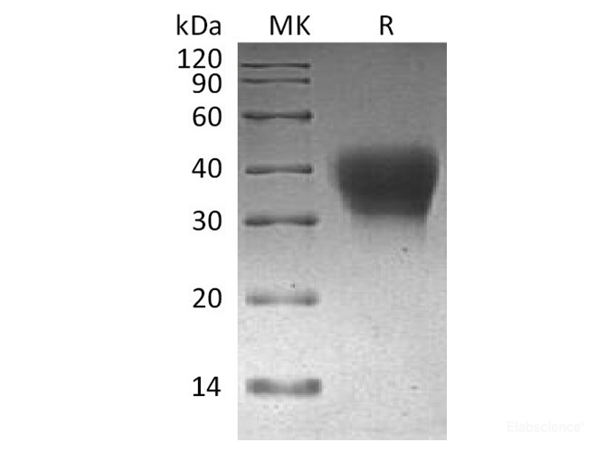 Recombinant Cynomolgus PD-1 / CD279 / PDCD1 Protein (C-His)-Elabscience