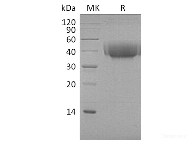 Recombinant Cynomolgus B7-1 / CD80 Protein (C-His)-Elabscience
