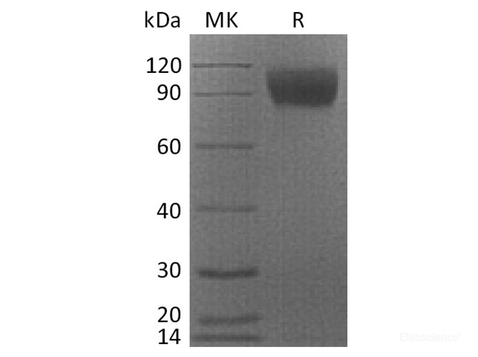Recombinant Cynomolgus CSF1R  /  MCSF Receptor  /  CD115 Protein Protein (C-His)-Elabscience